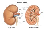 Fasting and Kidney Problems