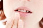 Mouth Cankers Remedies
