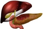 Pancreas Cyst Treatment